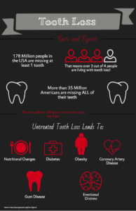 tooth loss facts and figures